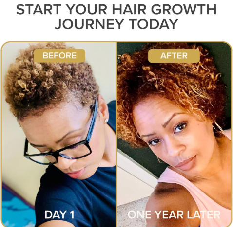 conic natural hair vitamins for fast hair growth, pure hair supplements formulated with vitamins to promote thicker, stronger hair 2