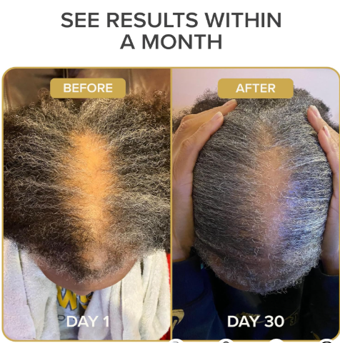 conic natural hair vitamins for fast hair growth, pure hair supplements formulated with vitamins to promote thicker, stronger hair 4