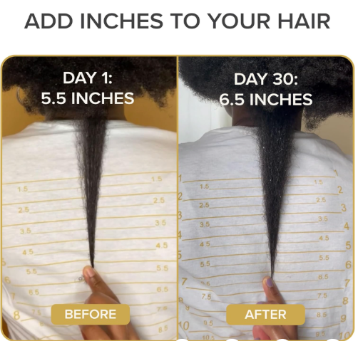 conic natural hair vitamins for fast hair growth, pure hair supplements formulated with vitamins to promote thicker, stronger hair 9